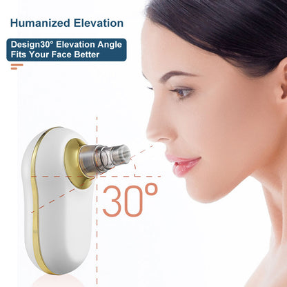 Electric Blackhead Remover Kit